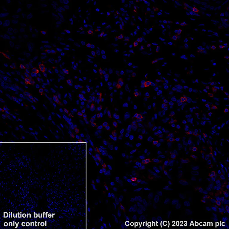 Immunohistochemistry (Formalin/PFA-fixed paraffin-embedded sections) - Alexa Fluor® 647 Anti-CD69 antibody [EPR21814] (AB313397)