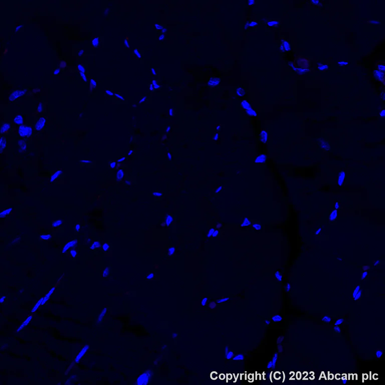 Immunohistochemistry (Formalin/PFA-fixed paraffin-embedded sections) - Alexa Fluor® 647 Anti-CD69 antibody [EPR21814] (AB313397)