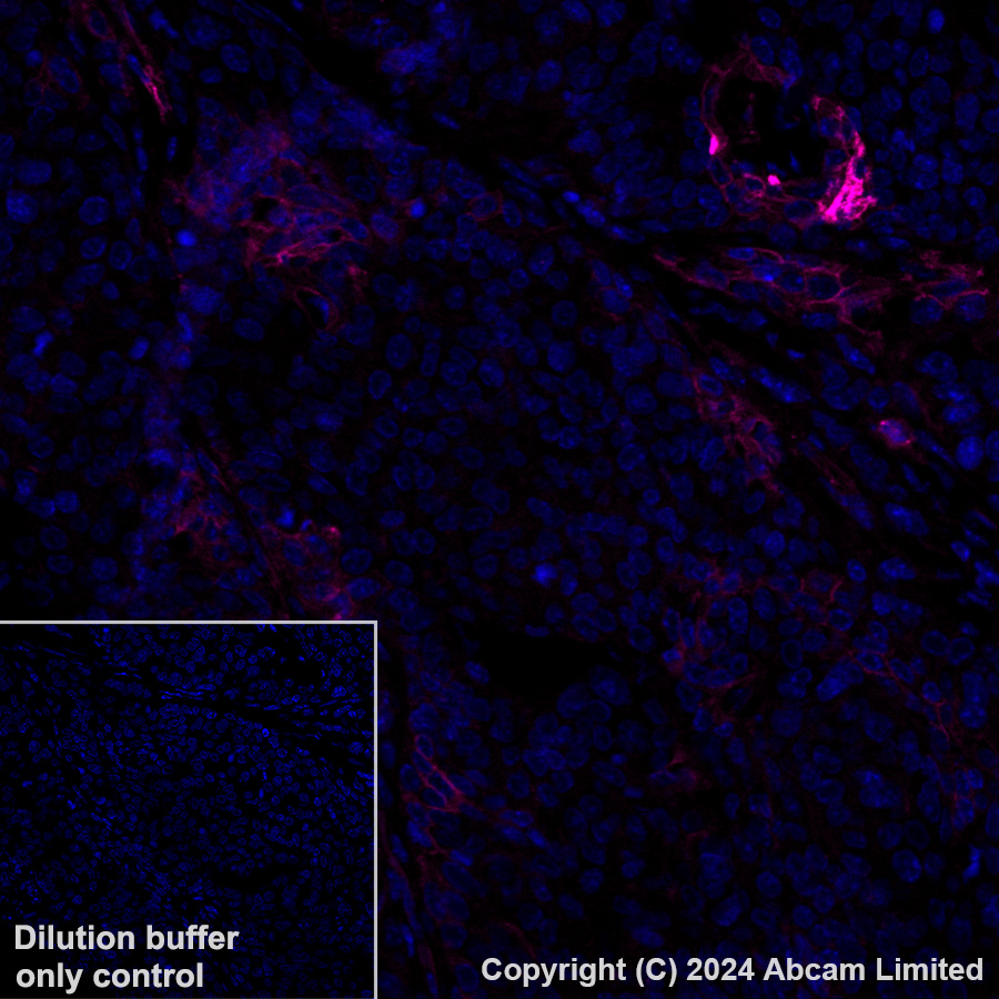 Immunohistochemistry (Formalin/PFA-fixed paraffin-embedded sections) - Alexa Fluor® 647 Anti-CD73 antibody [EPR28214-169] (AB322321), expandable thumbnail