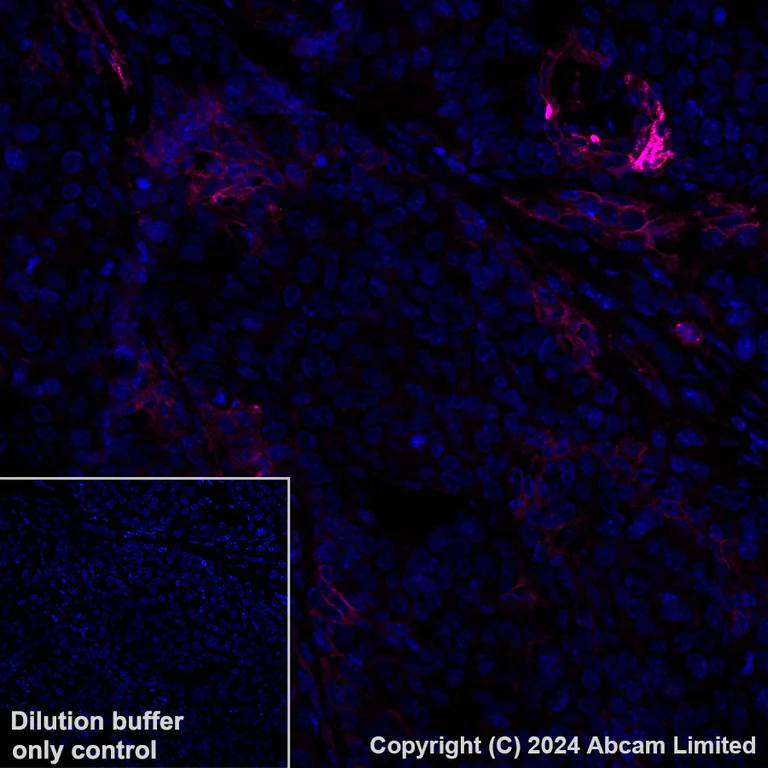 Immunohistochemistry (Formalin/PFA-fixed paraffin-embedded sections) - Alexa Fluor® 647 Anti-CD73 antibody [EPR28214-169] (AB322321)