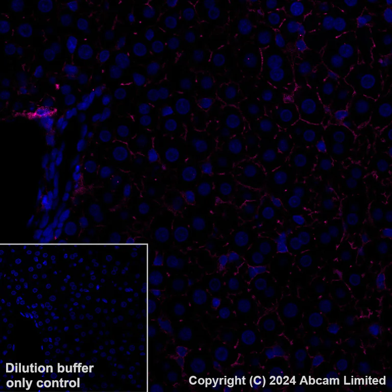 Immunohistochemistry (Formalin/PFA-fixed paraffin-embedded sections) - Alexa Fluor® 647 Anti-CD73 antibody [EPR28214-169] (AB322321)