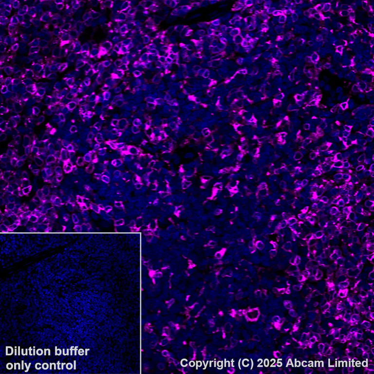 Immunohistochemistry (Formalin/PFA-fixed paraffin-embedded sections) - Alexa Fluor® 647 Anti-CD74 antibody [EPR25399-94] (AB325691)