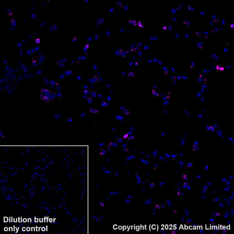 Immunohistochemistry (Formalin/PFA-fixed paraffin-embedded sections) - Alexa Fluor® 647 Anti-CD74 antibody [EPR25399-94] (AB325691)