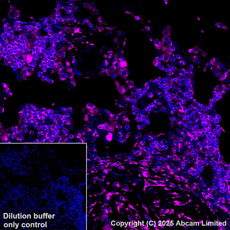 Immunohistochemistry (Formalin/PFA-fixed paraffin-embedded sections) - Alexa Fluor® 647 Anti-CD74 antibody [EPR25399-94] (AB325691)