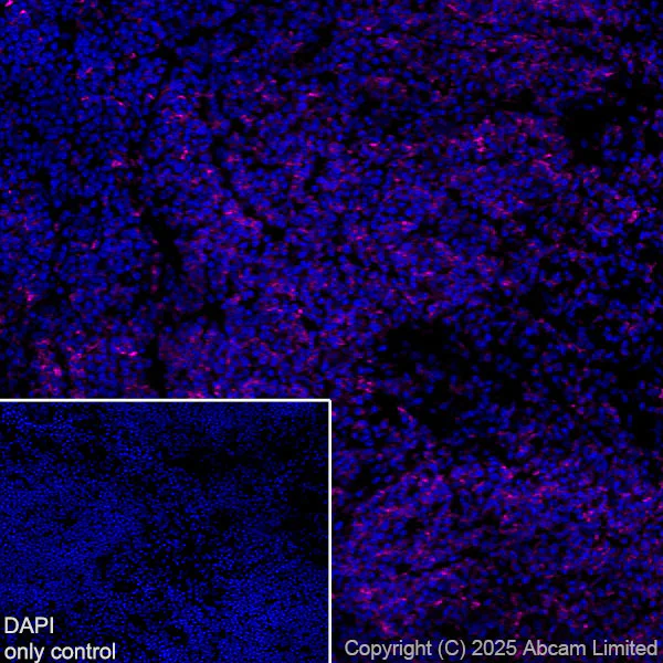 Immunohistochemistry (Frozen sections) - Alexa Fluor® 647 Anti-CD74 antibody [EPR25399-94] (AB325691)
