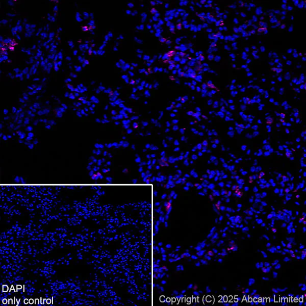 Immunohistochemistry (Frozen sections) - Alexa Fluor® 647 Anti-CD74 antibody [EPR25399-94] (AB325691)