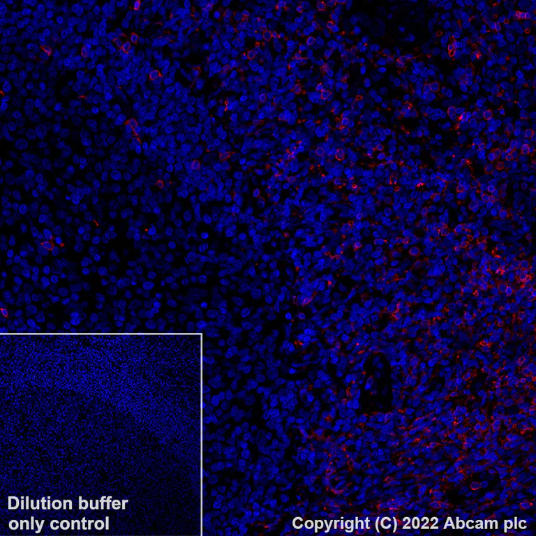 Immunohistochemistry (Formalin/PFA-fixed paraffin-embedded sections) - Alexa Fluor® 647 Anti-CD8 alpha antibody [CAL66] (AB305048)