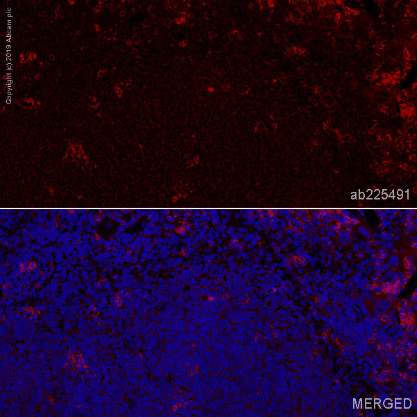 Immunohistochemistry (Formalin/PFA-fixed paraffin-embedded sections) - Alexa Fluor® 647 Anti-CD8 alpha antibody [EPR20305] (AB225491)