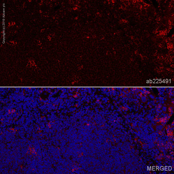 Immunohistochemistry (Formalin/PFA-fixed paraffin-embedded sections) - Alexa Fluor® 647 Anti-CD8 alpha antibody [EPR20305] (AB225491)