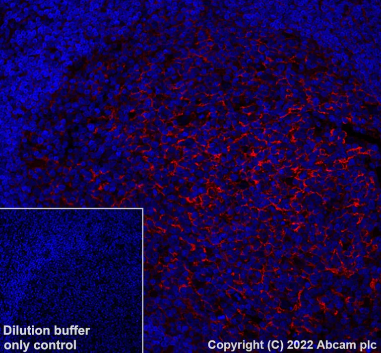 Immunohistochemistry (Formalin/PFA-fixed paraffin-embedded sections) - Alexa Fluor® 647 Anti-CD81 antibody [EPR21916] (AB303459)