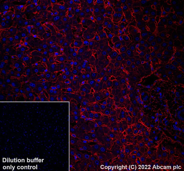Immunohistochemistry (Formalin/PFA-fixed paraffin-embedded sections) - Alexa Fluor® 647 Anti-CD81 antibody [EPR21916] (AB303459)