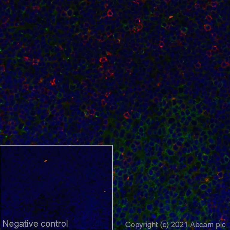 Immunohistochemistry (Formalin/PFA-fixed paraffin-embedded sections) - Alexa Fluor® 647 Anti-CD83 antibody [EPR23809-19] (AB286828)