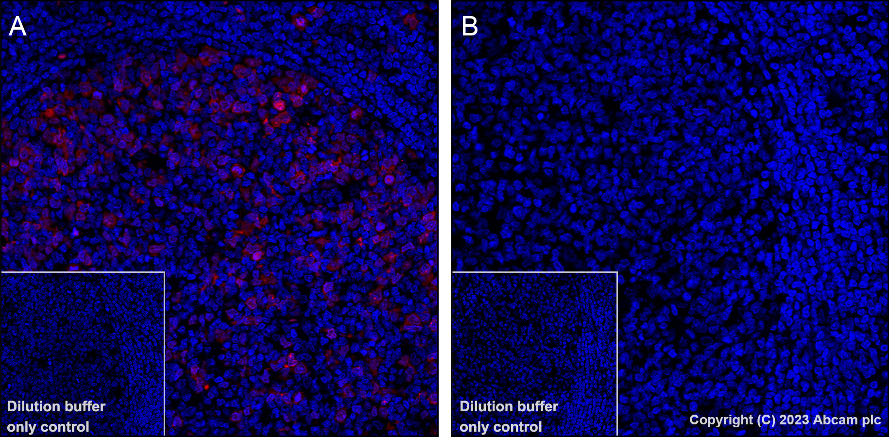 Immunohistochemistry (Formalin/PFA-fixed paraffin-embedded sections) - Alexa Fluor® 647 Anti-CDK1 + Cdk2 + Cdk3 (phospho T14) antibody [E161] (AB314673), expandable thumbnail
