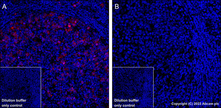 Immunohistochemistry (Formalin/PFA-fixed paraffin-embedded sections) - Alexa Fluor® 647 Anti-CDK1 + Cdk2 + Cdk3 (phospho T14) antibody [E161] (AB314673)