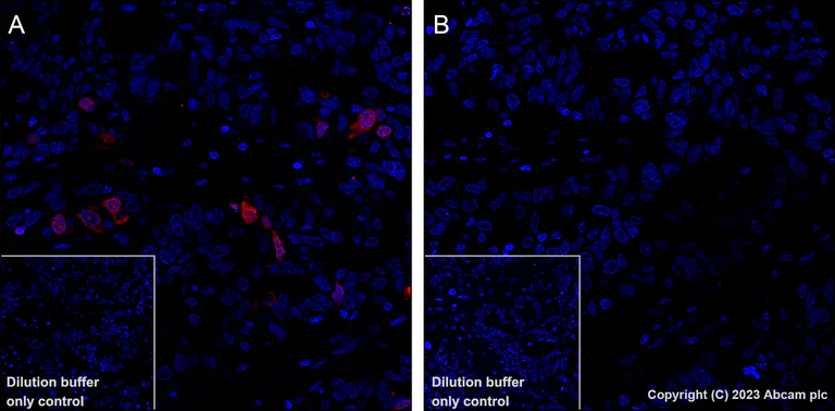 Immunohistochemistry (Formalin/PFA-fixed paraffin-embedded sections) - Alexa Fluor® 647 Anti-CDK1 + Cdk2 + Cdk3 (phospho T14) antibody [E161] (AB314673)