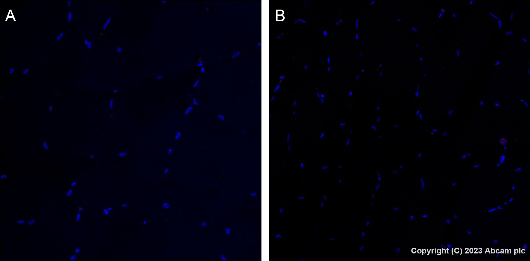 Immunohistochemistry (Formalin/PFA-fixed paraffin-embedded sections) - Alexa Fluor® 647 Anti-CDK1 + Cdk2 + Cdk3 (phospho T14) antibody [E161] (AB314673), expandable thumbnail