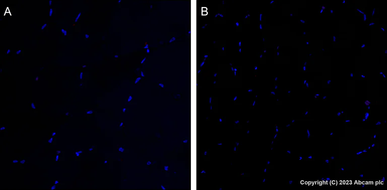 Immunohistochemistry (Formalin/PFA-fixed paraffin-embedded sections) - Alexa Fluor® 647 Anti-CDK1 + Cdk2 + Cdk3 (phospho T14) antibody [E161] (AB314673)