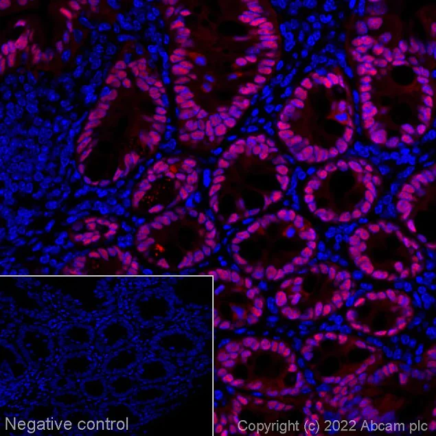 Immunohistochemistry (Formalin/PFA-fixed paraffin-embedded sections) - Alexa Fluor® 647 Anti-CDX2 antibody [EPR2764Y] (AB195008)