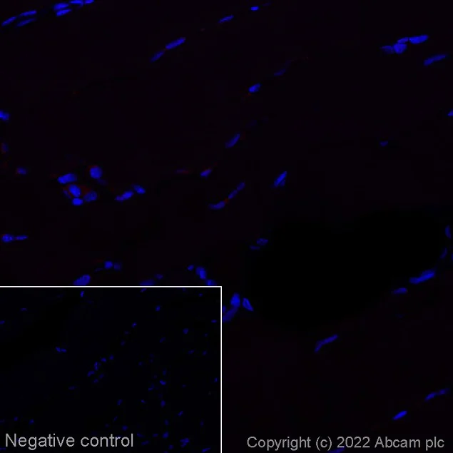 Immunohistochemistry (Formalin/PFA-fixed paraffin-embedded sections) - Alexa Fluor® 647 Anti-CDX2 antibody [EPR2764Y] (AB195008)