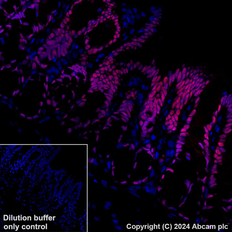 Immunohistochemistry (Formalin/PFA-fixed paraffin-embedded sections) - Alexa Fluor® 647 Anti-CDX2 antibody [EPR2764Y] (AB195008)