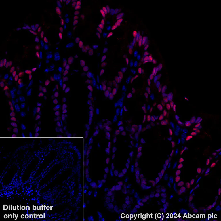 Immunohistochemistry (Formalin/PFA-fixed paraffin-embedded sections) - Alexa Fluor® 647 Anti-CDX2 antibody [EPR2764Y] (AB195008)