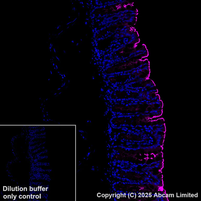 Immunohistochemistry (Formalin/PFA-fixed paraffin-embedded sections) - Alexa Fluor® 647 Anti-CEACAM5 antibody [EPR28723-86] (AB324338)