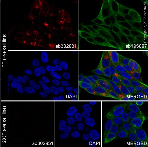 Immunocytochemistry/ Immunofluorescence - Alexa Fluor® 647 Anti-CGRP-I+CGRP-II antibody [EPR23804-95] (AB302831)