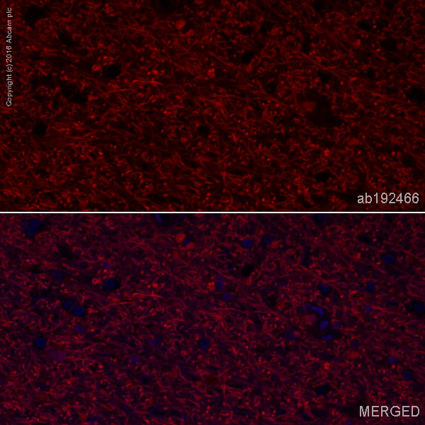 Immunohistochemistry (Formalin/PFA-fixed paraffin-embedded sections) - Alexa Fluor® 647 Anti-Choline Acetyltransferase antibody [EPR13024(B)] (AB192466), expandable thumbnail