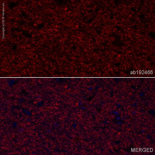Immunohistochemistry (Formalin/PFA-fixed paraffin-embedded sections) - Alexa Fluor® 647 Anti-Choline Acetyltransferase antibody [EPR13024(B)] (AB192466)