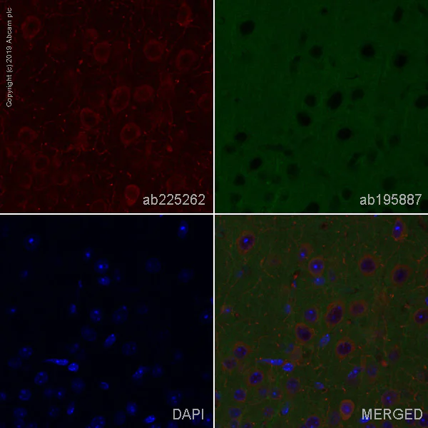 Immunohistochemistry (Formalin/PFA-fixed paraffin-embedded sections) - Alexa Fluor® 647 Anti-Choline Acetyltransferase antibody [EPR16590] (AB225262)