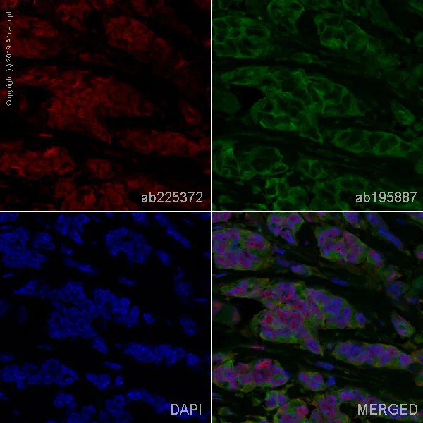 Immunohistochemistry (Formalin/PFA-fixed paraffin-embedded sections) - Alexa Fluor® 647 Anti-CIRP antibody [EPR18783] (AB225372)