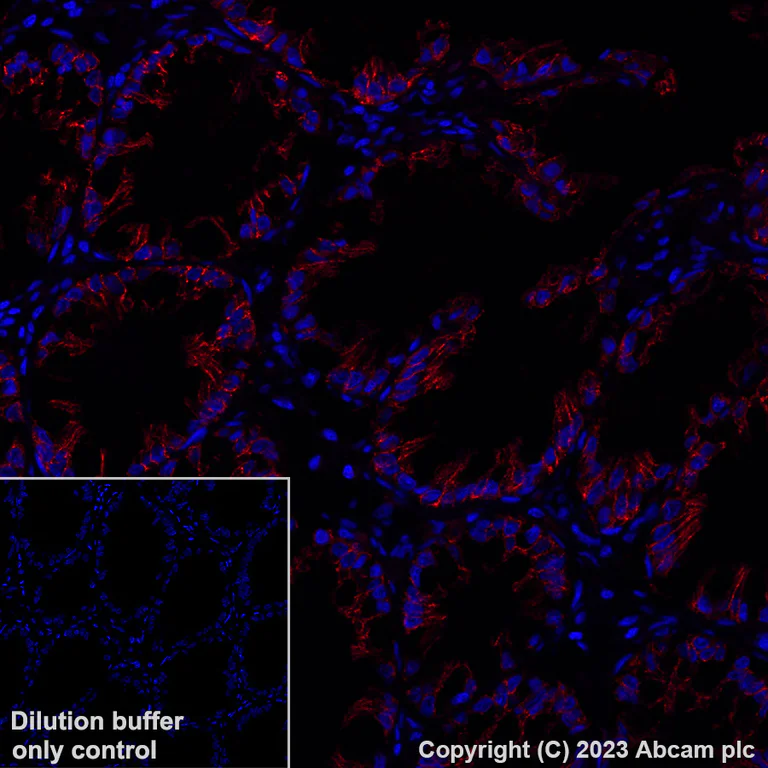 Immunohistochemistry (Formalin/PFA-fixed paraffin-embedded sections) - Alexa Fluor® 647 Anti-Claudin 1 antibody [EPR25359-48] (AB316340)