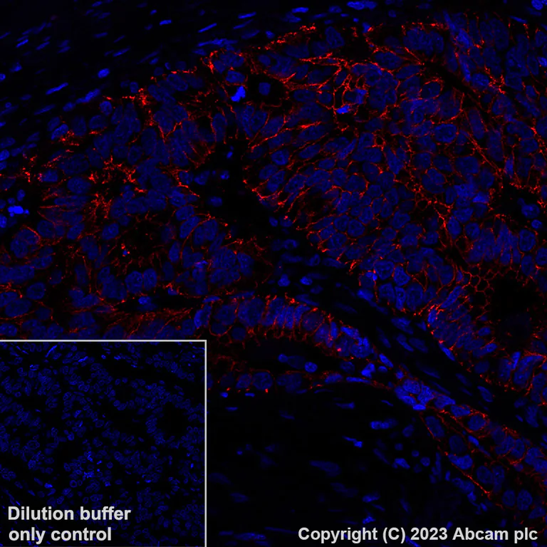 Immunohistochemistry (Formalin/PFA-fixed paraffin-embedded sections) - Alexa Fluor® 647 Anti-Claudin 1 antibody [EPR25359-48] (AB316340)