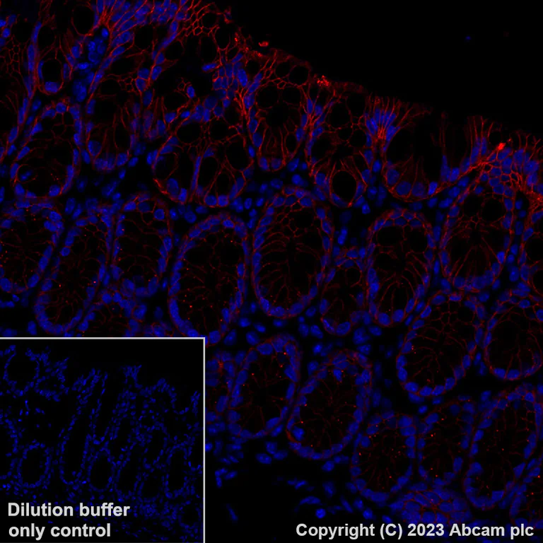Immunohistochemistry (Formalin/PFA-fixed paraffin-embedded sections) - Alexa Fluor® 647 Anti-Claudin 1 antibody [EPR25359-48] (AB316340)