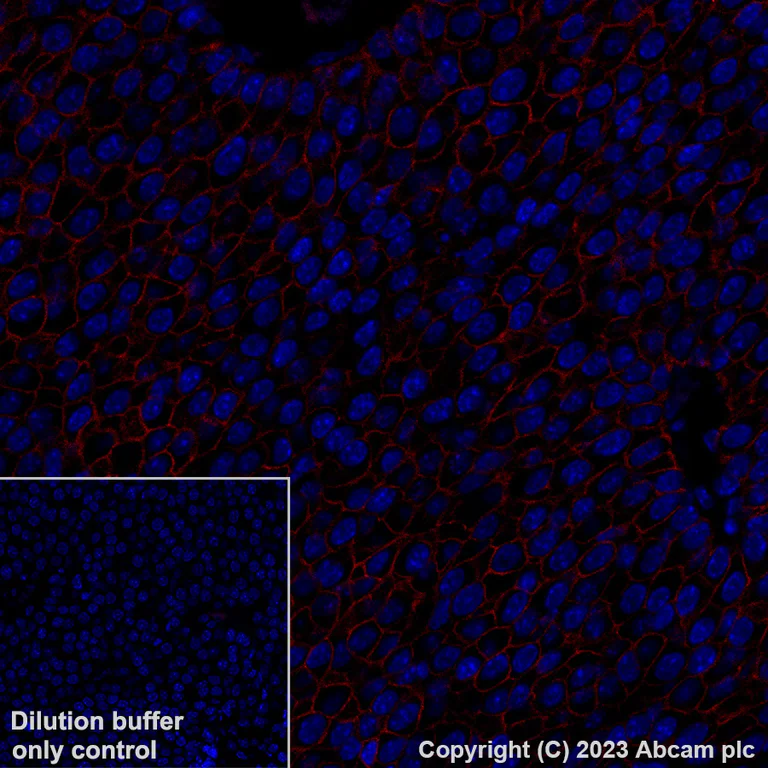 Immunohistochemistry (Formalin/PFA-fixed paraffin-embedded sections) - Alexa Fluor® 647 Anti-Claudin 1 antibody [EPR25359-48] (AB316340)