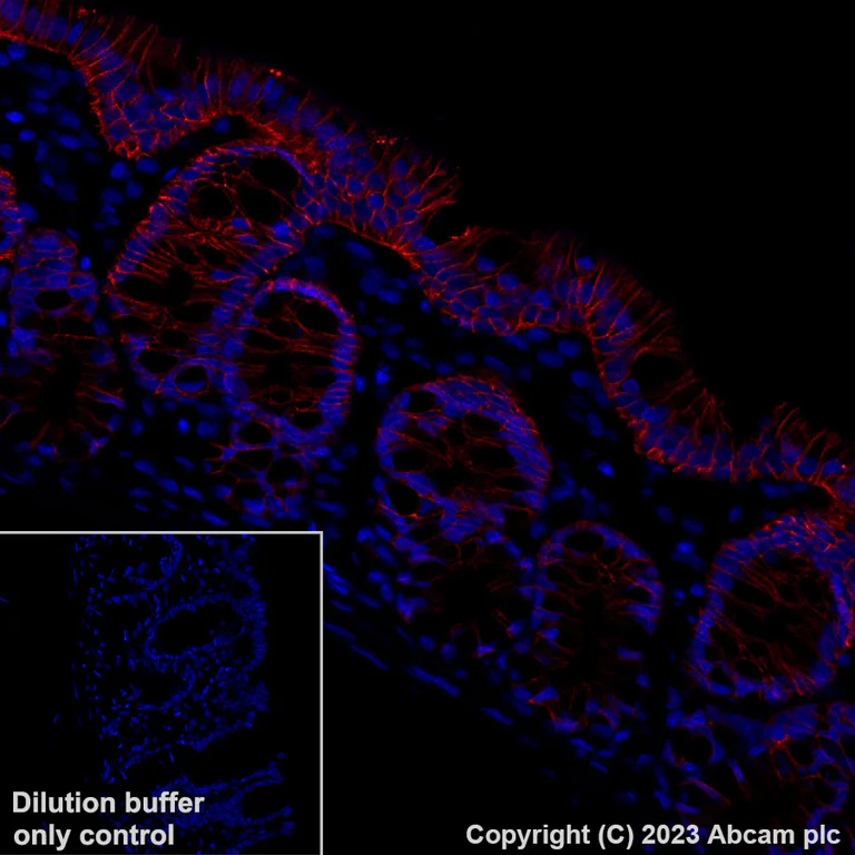 Immunohistochemistry (Formalin/PFA-fixed paraffin-embedded sections) - Alexa Fluor® 647 Anti-Claudin 1 antibody [EPR25359-48] (AB316340)