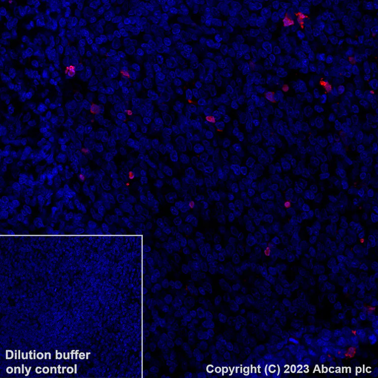 Immunohistochemistry (Formalin/PFA-fixed paraffin-embedded sections) - Alexa Fluor® 647 Anti-Cleaved PARP1 antibody [SP276] (AB315355)