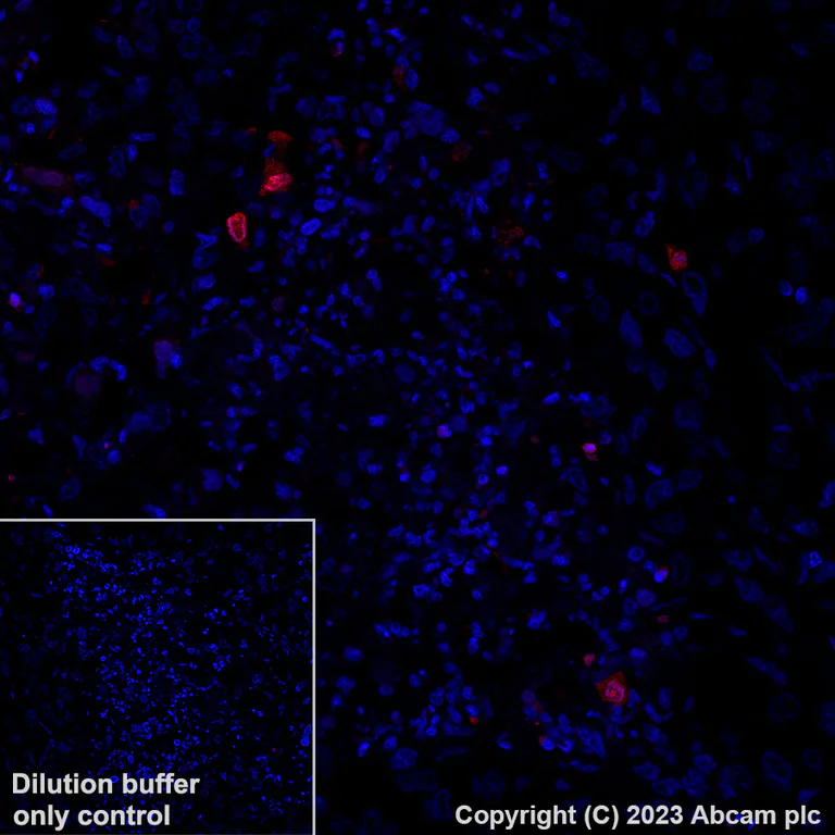 Immunohistochemistry (Formalin/PFA-fixed paraffin-embedded sections) - Alexa Fluor® 647 Anti-Cleaved PARP1 antibody [SP276] (AB315355)