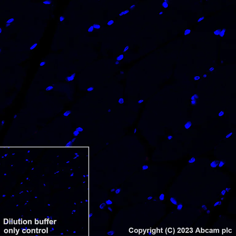 Immunohistochemistry (Formalin/PFA-fixed paraffin-embedded sections) - Alexa Fluor® 647 Anti-Cleaved PARP1 antibody [SP276] (AB315355)