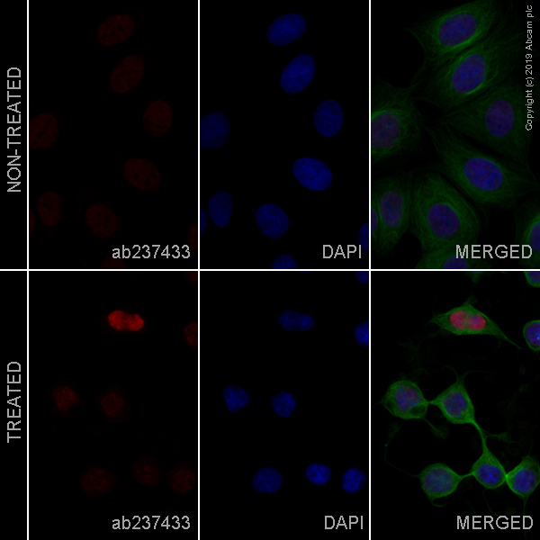 Immunocytochemistry/ Immunofluorescence - Alexa Fluor® 647 Anti-Cleaved PARP1 antibody [Y34] (AB237433)