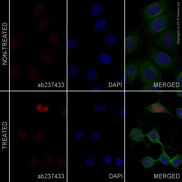 Immunocytochemistry/ Immunofluorescence - Alexa Fluor® 647 Anti-Cleaved PARP1 antibody [Y34] (AB237433)