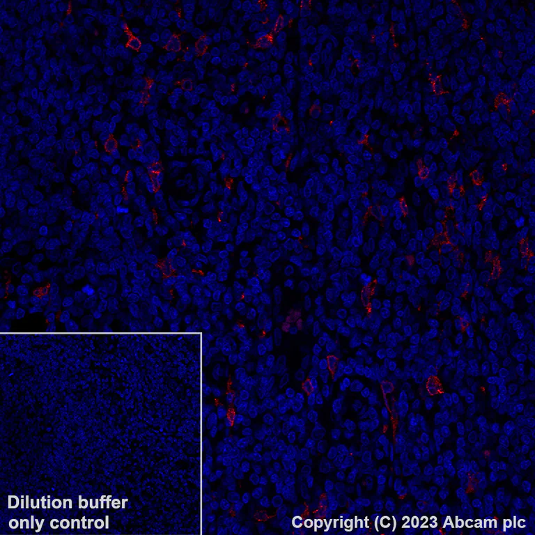 Immunohistochemistry (Formalin/PFA-fixed paraffin-embedded sections) - Alexa Fluor® 647 Anti-CLEC9A antibody [EPR22324] (AB315359)