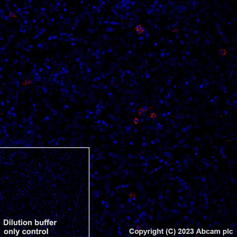 Immunohistochemistry (Formalin/PFA-fixed paraffin-embedded sections) - Alexa Fluor® 647 Anti-CLEC9A antibody [EPR22324] (AB315359)