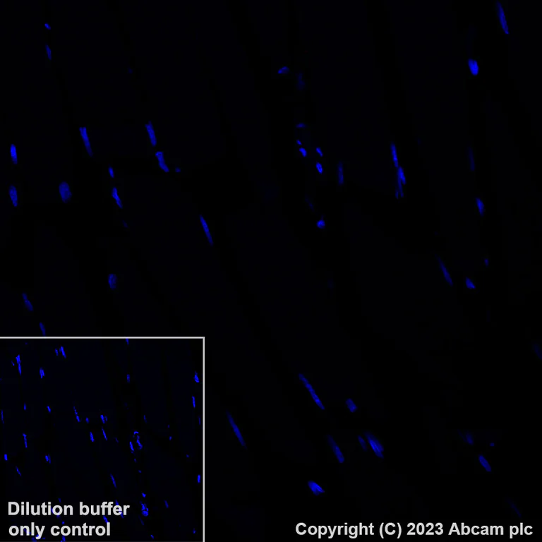 Immunohistochemistry (Formalin/PFA-fixed paraffin-embedded sections) - Alexa Fluor® 647 Anti-CLEC9A antibody [EPR22324] (AB315359)