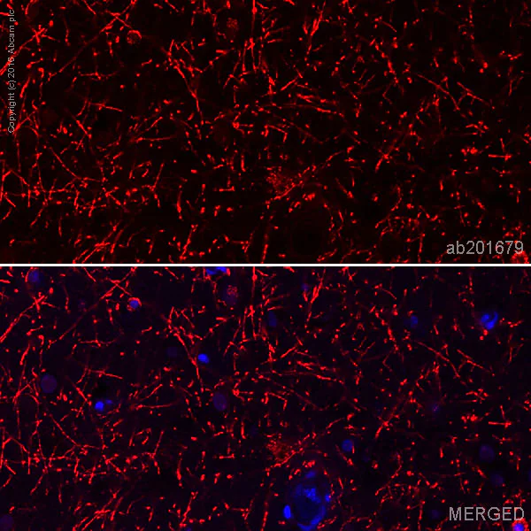 Immunohistochemistry (Formalin/PFA-fixed paraffin-embedded sections) - Alexa Fluor® 647 Anti-CNPase antibody [11-5B] (AB201679)