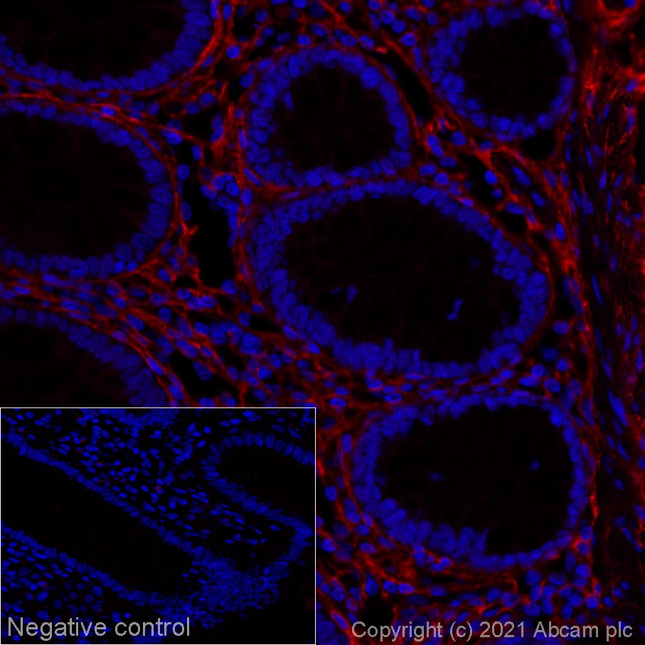 Immunohistochemistry (Formalin/PFA-fixed paraffin-embedded sections) - Alexa Fluor® 647 Anti-COL1A2 antibody [EPR24262-52] (AB281330), expandable thumbnail