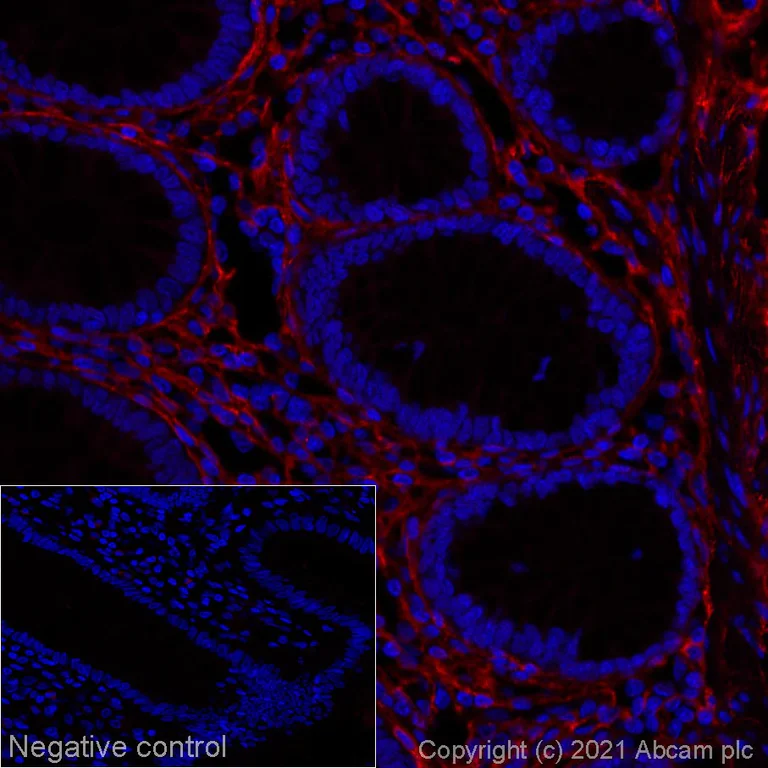 Immunohistochemistry (Formalin/PFA-fixed paraffin-embedded sections) - Alexa Fluor® 647 Anti-COL1A2 antibody [EPR24262-52] (AB281330)