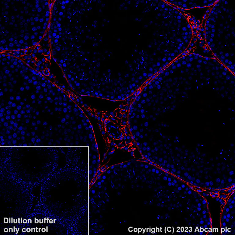 Immunohistochemistry (Formalin/PFA-fixed paraffin-embedded sections) - Alexa Fluor® 647 Anti-Collagen I antibody [EPR24331-53] (AB309367)