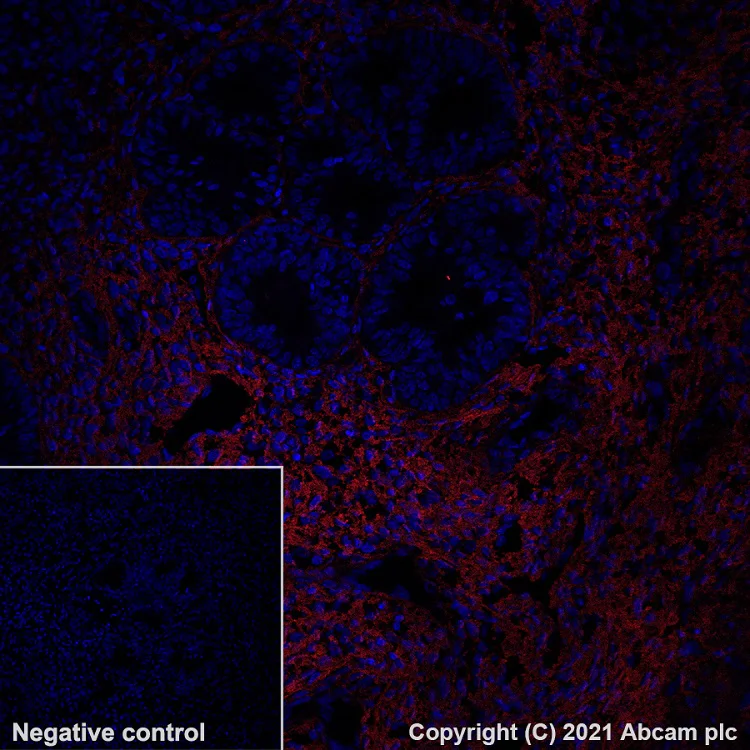 Immunohistochemistry (Formalin/PFA-fixed paraffin-embedded sections) - Alexa Fluor® 647 Anti-Collagen I antibody [EPR7785] (AB280968)