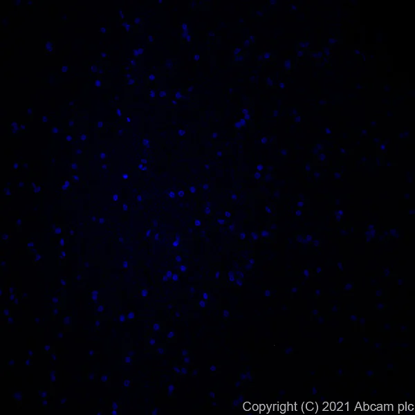 Immunohistochemistry (Formalin/PFA-fixed paraffin-embedded sections) - Alexa Fluor® 647 Anti-Collagen I antibody [EPR7785] (AB280968)